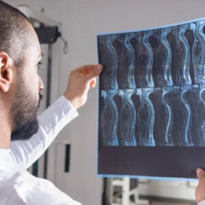 pain doctor spinal cord stimulator