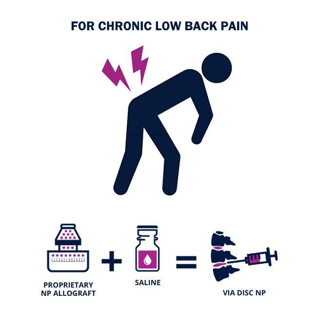 VIA Disc NP equation w image